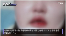 여자 초등생 때린 남자 중학생